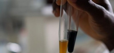Côte d'Ivoire : Un Biomédecin chercheur annonce la mis sur pied d'une molécule qui guérit la COVID-19, connue des autorités du pays qui reste sans promotion