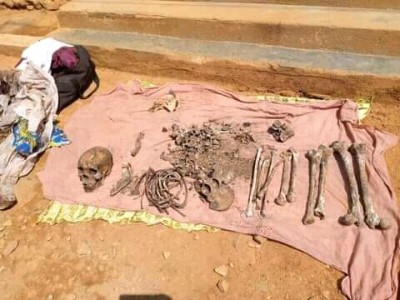 Cameroun : Trafic d'ossements humains,  démantèlement d'un réseau de cinq présumés trafiquants à l'ouest