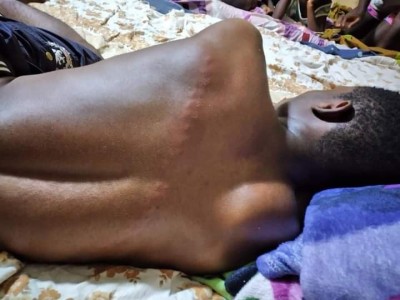 Côte d'Ivoire : Yamoussoukro, un jeune violemment frappé et laissé dans un état comateux par des bandits qui voulaient sa moto