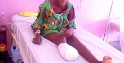 Cameroun : Son pied découpé à la machette pour une affaire de spaghettis