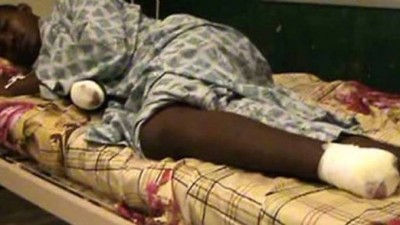 Mali : Des civils accusés de vol amputés à Gao , réactions de la Minusma et de l'armée