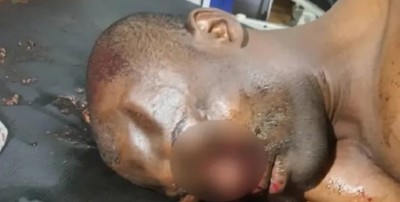 Côte d'Ivoire : Odiénné, un gendarme lutte avec la mort après avoir heurté violemment et cheval errant