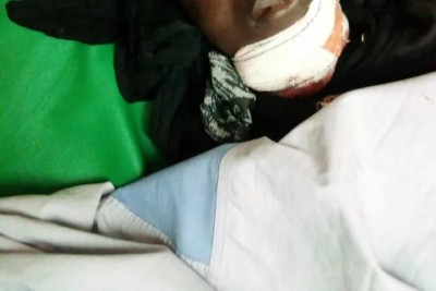 Côte d'Ivoire : Anyama, suite à une chaude discussion, un élément de la garde rapprochée d'un ministre se sert de son arme de dotation et tire sur un jeune footballeur