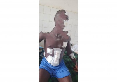 Côte d'Ivoire : Forêt classée de Dassioko (Fresco), un individu ouvre le feu sur des agents de la Sodefor, un blessé grave