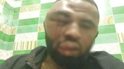 Cameroun : Paul Chouta journaliste et lanceur d'alerte enlevé et torturé par des inconnus