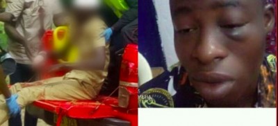 Côte d'Ivoire : Lakota, pour une somme de 1000 FCFA, un élève copieusement battu par ses camarades, se plaint d'une tumeur à l'œil gauche