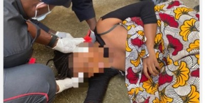 Côte d'Ivoire : Cocody,  une jeune fille fait une chute depuis le 4eme niveau d'un immeuble, fractures aux deux membres inférieurs