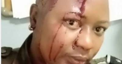 Cameroun : Yaoundé, deux policières blessées dans l'attaque d'un poste de police