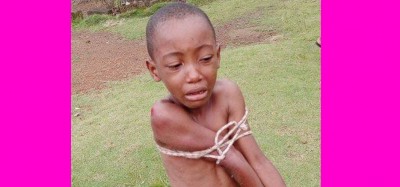 Liberia :  Un enfant sauvé des liens de torture continue