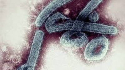 Guinée-Equatoriale : Virus de Marburg , Malabo annonce 11 morts confirmées