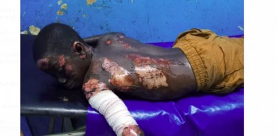Côte d'Ivoire : Drame à Daloa, surpris dans leur sommeil par un incendie, 03 enfants brûlés au second degré, 02 perdent la vie