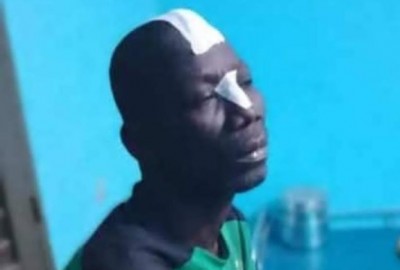 Côte d'Ivoire : Bangolo, conflit au village de Gloplou-Zibiao, l'investiture du chef vire à l'affrontement