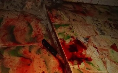 Côte d'Ivoire : Tentative de meurtre à Yopougon, une romance transformée en cauchemar