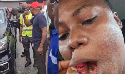 Côte d'Ivoire : Violence en pleine journée à Cocody, une mère agressée sous les yeux de ses enfants, l'indignation des passants