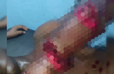 Côte d'Ivoire : Bouaké, un jeune sauvagement tailladé par plusieurs gamins armés de machette