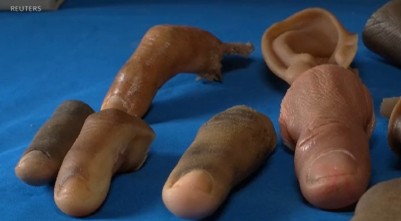 Nigeria : Des prothèses en bras bionique humanoïde pour soulager les victimes du terrorisme et accidentés