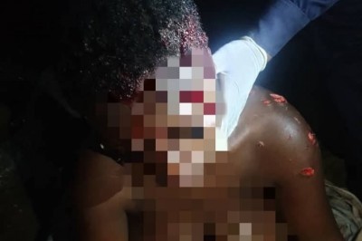 Côte d'Ivoire : Yopougon Gesco, une femme gravement blessée dans un hôtel, évacuée d'urgence au CHU