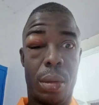 Côte d'Ivoire : Bangolo, une altercation nocturne entre deux enseignants vire à une agression grave