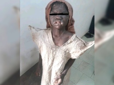 Côte d'Ivoire : Bouaké, accusée de vol ou de la mort de poulets, une fillette maltraitée et enfermée dans un poulailler par sa grand-mère