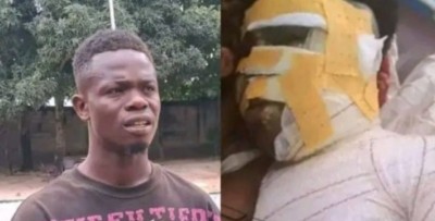 Côte d'Ivoire : Crise de jalousie à l'ouest ? Il asperge sa compagne de carburant  et met le feu
