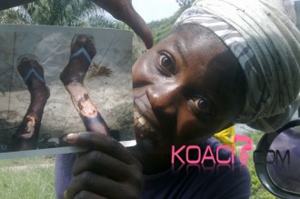 COTE D'IVOIRE: La mendicité photo apparait à  Abidjan