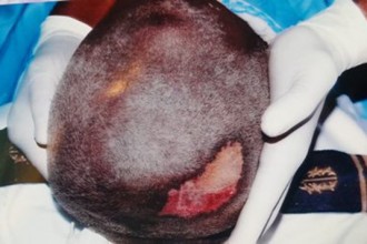 Gabon : Soupçons de trafic dÂ’organes humains à  Gabosep Oyem