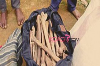 Cameroun : Il sÂ’achète 4 villas avec le commerce juteux des organes humains