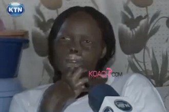 Kenya : Il défigure sa femme parce quÂ’il la juge trop belle et infidèle