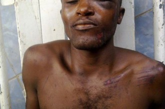 Gabon : Un homme torturé puis jeté d'un véhicule près de Lambaréné