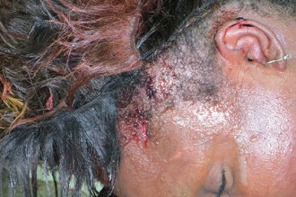 Gabon : Le corps d'une femme assassinée retrouvé à  Libreville