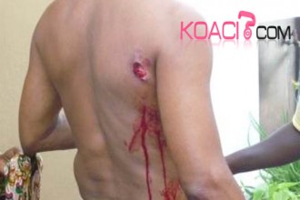 TOGO: Les forces de sécurité font usage de balles en caoutchouc