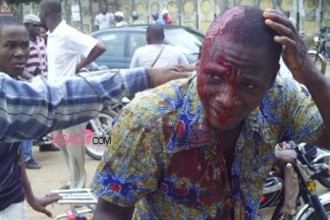 Bruits de grenades et de grève de la faim à  Lomé