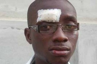 BENIN: François Mensah de Canal 3 Benin bastonné par des forces de lÂ’ordre