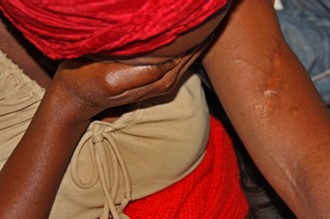 TOGO : Les victimes de la torture montent au créneau