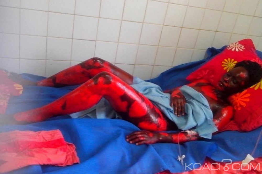Gabon: Des dégà¢ts corporels et matériels importants après une mystérieuse détonation