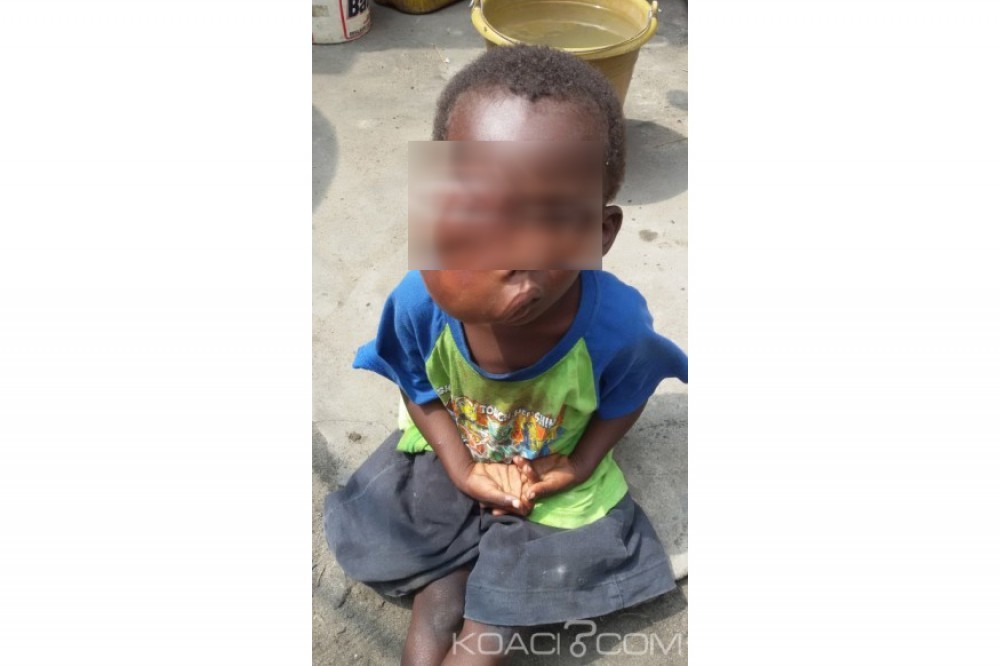 Côte d'Ivoire : Un enfant qui pourrait mourir d'ici  un mois s'il n'est pas opéré, abandonné à  son propre sort au  CHU