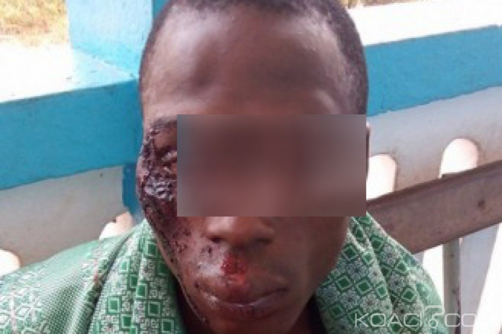 Côte d'Ivoire: Prétextant un couvre-feu, les Dozos chargent les villageois à  l'ouest du pays, plusieurs blessés par balles