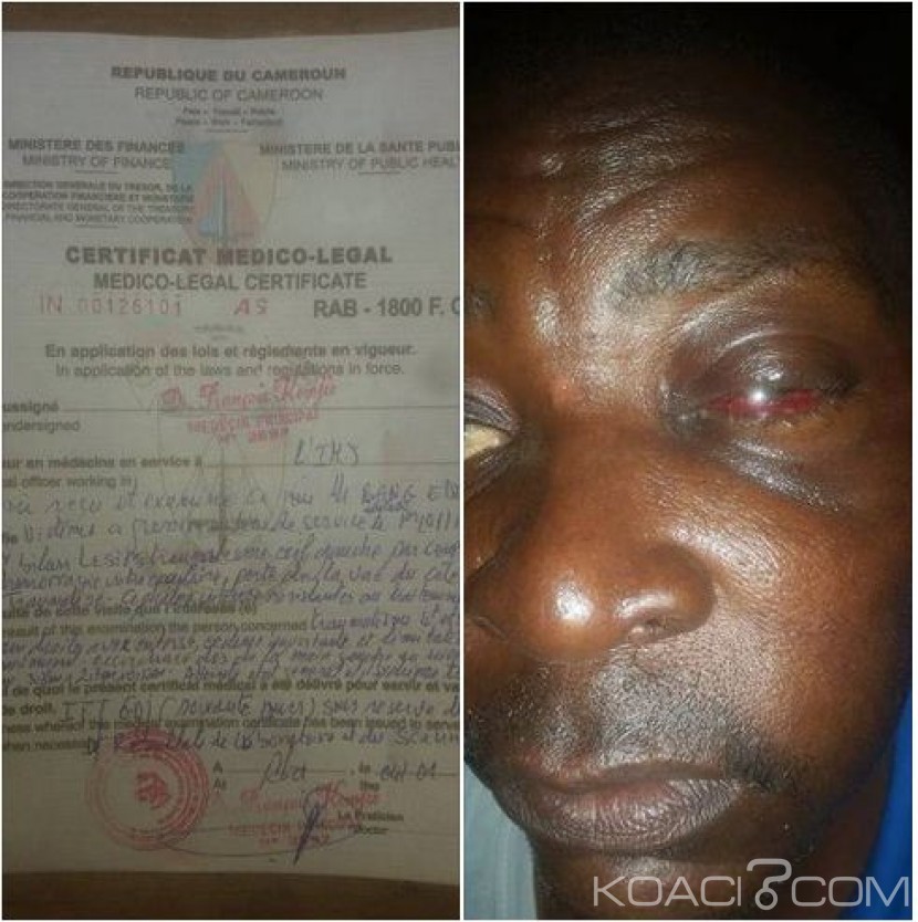 Cameroun: Bertoua, un adjoint du sous-préfet tabasse copieusement un commerçant