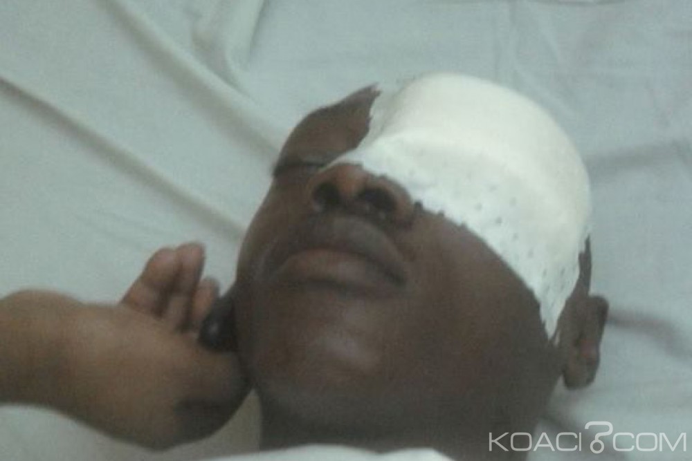 Gabon: Un homme crève un oeil à  un autre à  l'aide d'une bouteille à  Mandji