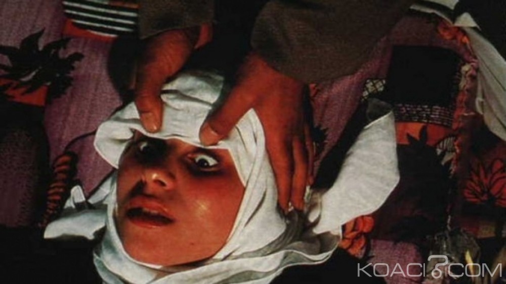 Maroc: Brûlée au 3ème degré lors d'une séance d'exorcisme