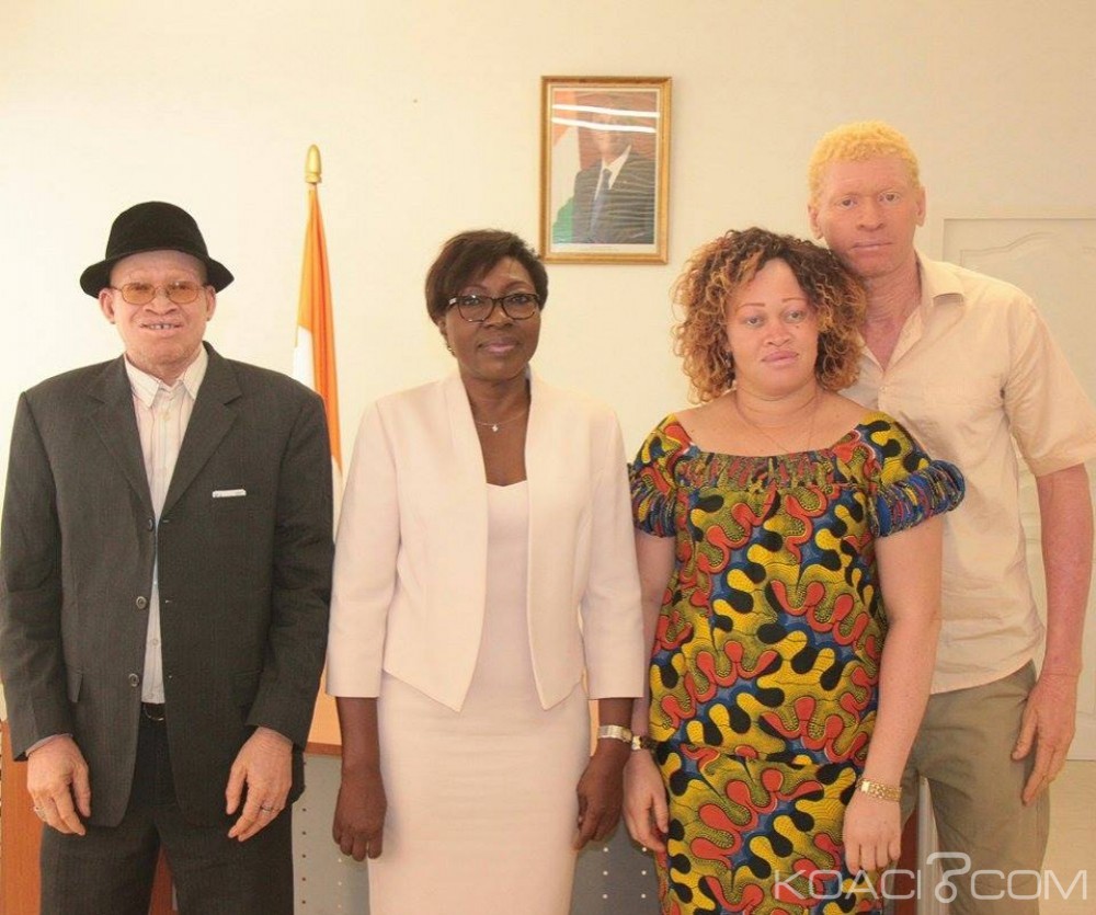 Côte d'Ivoire: Le Gouvernement marque sa solidarité avec les personnes vivant avec l'albinisme