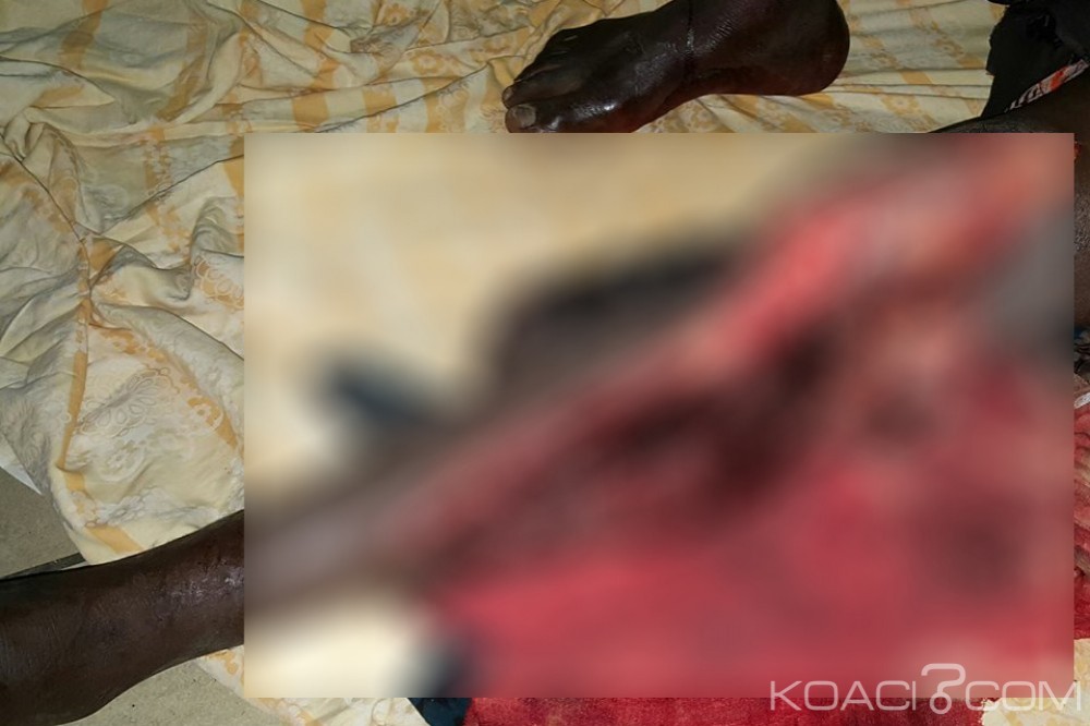 Côte d'Ivoire: Soupçonnés de vol et agression, deux individus lynchés à  mort  à  Yopougon