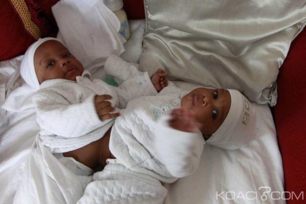 Burkina Faso: Deux bébés siamois de deux semaines séparés avec succès
