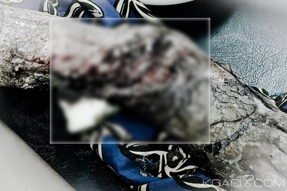 Côte d'Ivoire: Maudit par sa victime, un voleur pourrit vivant par les pieds