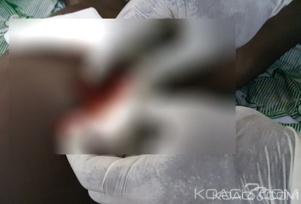 Côte d'Ivoire:Deux hommes meurent de la tuberculose en pleine rue