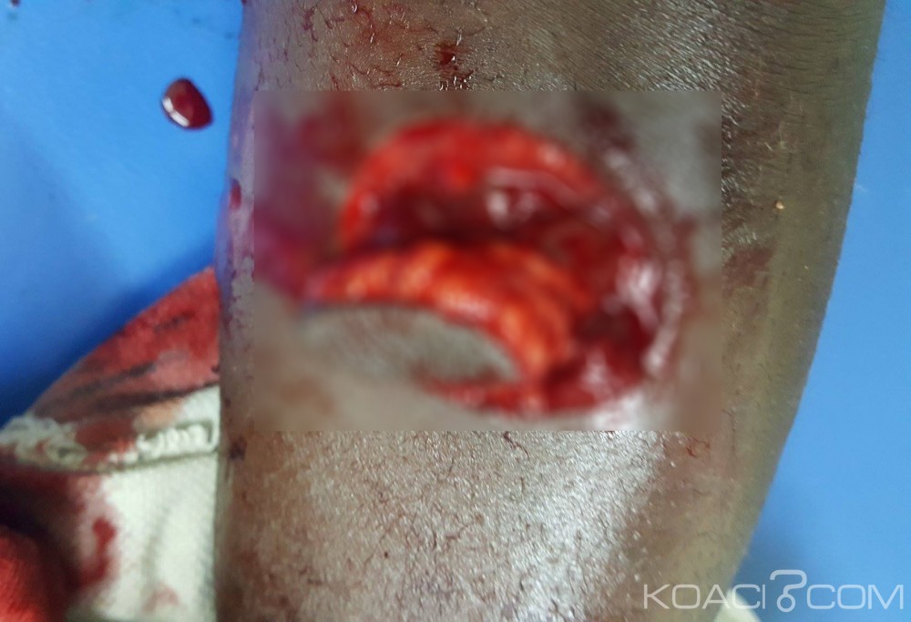 Côte d'Ivoire: Adjamé, décès d'un homme poignardé en pleine rue