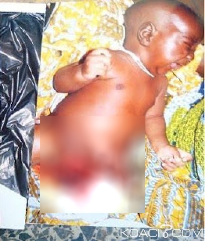 Nigeria: Chirurgie du pénis pour Buhari