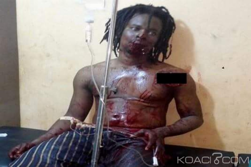 Ghana: Un féticheur trahi par ses forces et blessé