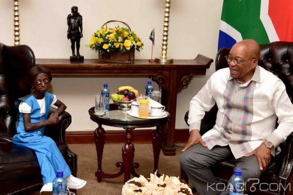 Afrique du Sud : Vœu de sa vie réalisé, la jeune Phalatse souffrante de Progeria a rencontré Zuma