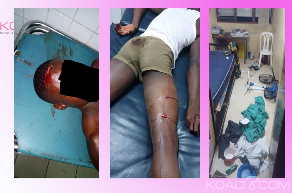 Côte d'Ivoire: Un affrontement éclate sur le campus tard dans la nuit, plusieurs innocents blessés